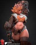 Squirrel Girl Statue, Resin Figure, Hand Painted, 18 cm (7.1 in)